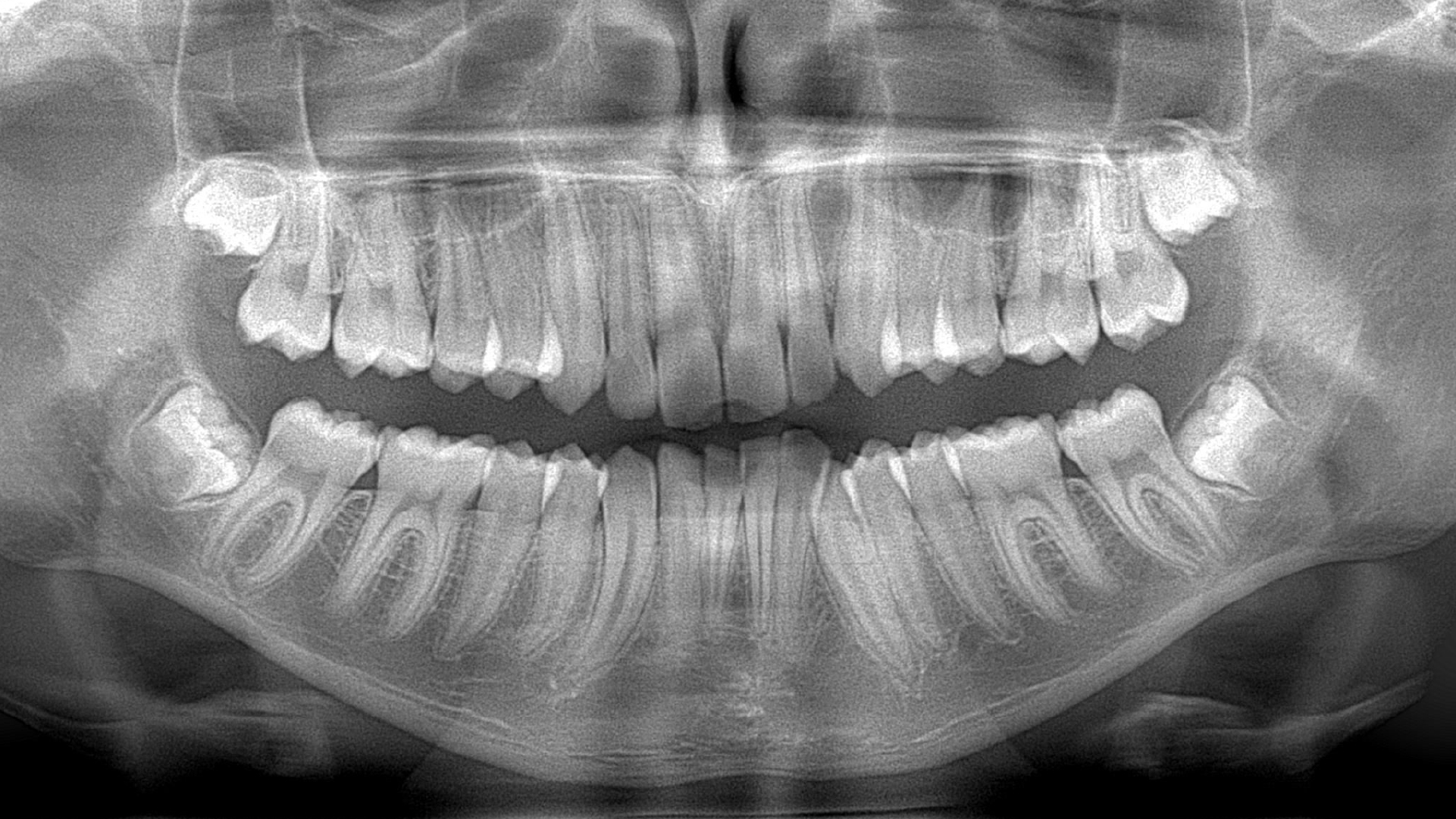 panoramica dentale